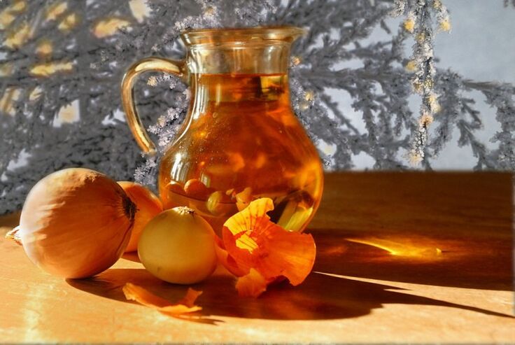 প্রোস্টাটাইটিসের জন্য পেঁয়াজের ক্বাথ